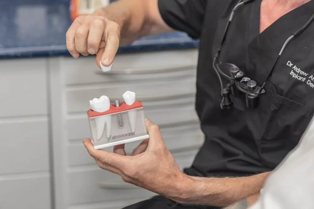 an image relating to the dental implant page